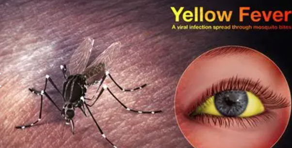 Public health surveillance data analysis