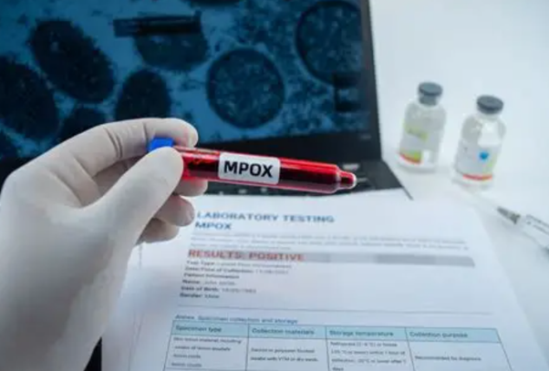 Microscope used for infectious disease research