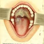 Diphtheria antitoxin is not magic: the importance of timing and supportive care